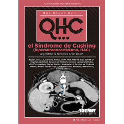 Qué Hacer Con... El Síndrome de Cushing