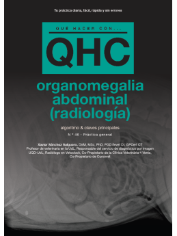 Qué Hacer Con...Organomegalia Abdominal (Radiología)