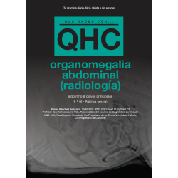 Qué Hacer Con...Organomegalia Abdominal (Radiología)
