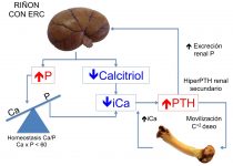 06_calcitriol
