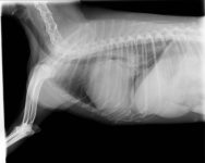 1. edema pulmonar intesrticial
