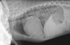 15. rx edema recidiva