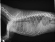 2. edema pulmonar alveolar
