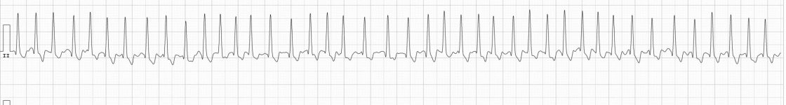20 - Electrocardiograma