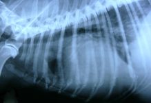 4. derrame pleural