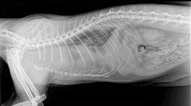 Efusión pleural