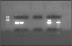 Figura 33. PCR anidada