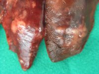 Foto 9b_Aelurostrongylus abstrusus lung lesions 3