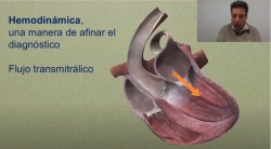 cevavideo1