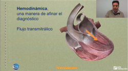 hemodinamica